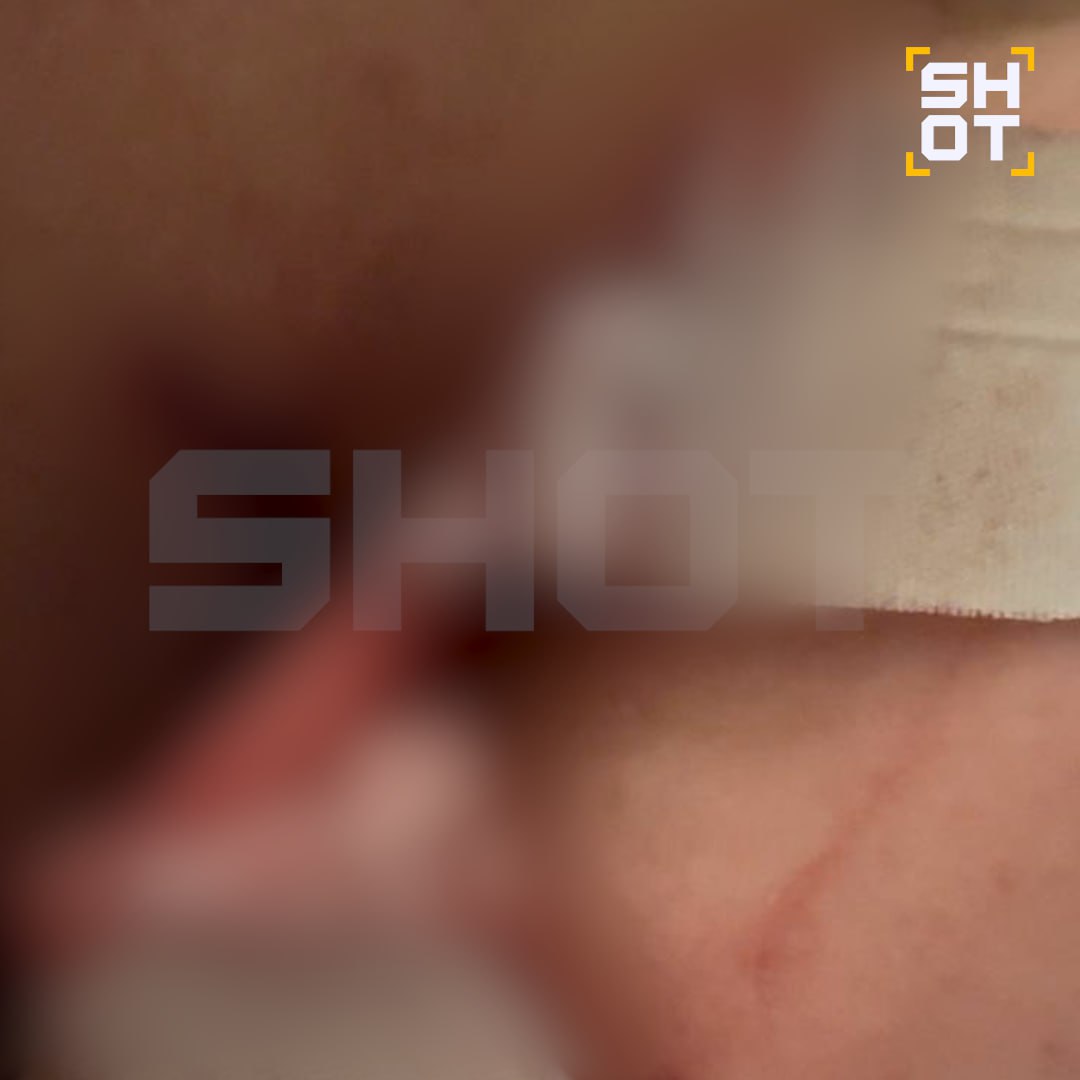 Любовник-араб случайно насадил москвичку на кран во время плотской утехи в душе египетского отеля. Он порвал ей тёмный тоннель — пришлось срочно ехать к врачу.   Как выяснил SHOT, пикантно неприятная история случилась с россиянкой, которая прилетела на отдых в Шарм-эль-Шейх. Туристка познакомилась с мужчиной и договорилась о встрече у него в номере. Парочка сразу пошла в душ, где вспыхнули страсти: мачо целовал девушку, прижав к стене кабинки. И насадил её на кран. Москвичка ощутила жуткую боль.   Сперва шальная дамочка терпела, но, когда началось сильное кровотечение и стало невмоготу, обратилась к врачам. Туристку в больнице бесплатно не приняли, так как она была подшофе. Рану между ягодиц зашивать не стали — всё обработали, забинтовали, рекомендовали несколько дней не мыться и пить антибиотики.   секс в формате КЖМ    SHOT в MAX:
