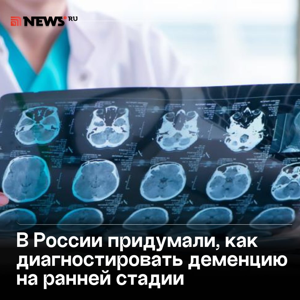 Российские ученые научились предсказывать Альцгеймер с точностью 89%. Исследователи из Пермского политеха создали метод ранней диагностики болезни — еще до появления симптомов. Все благодаря ИИ, который анализирует изменения в сосудах мозга после того, как пациенту делают МРТ с контрастом. Метод уже запатентован и может стать важным инструментом для врачей, сообщили ученые. Подписаться Прислать новость Буст