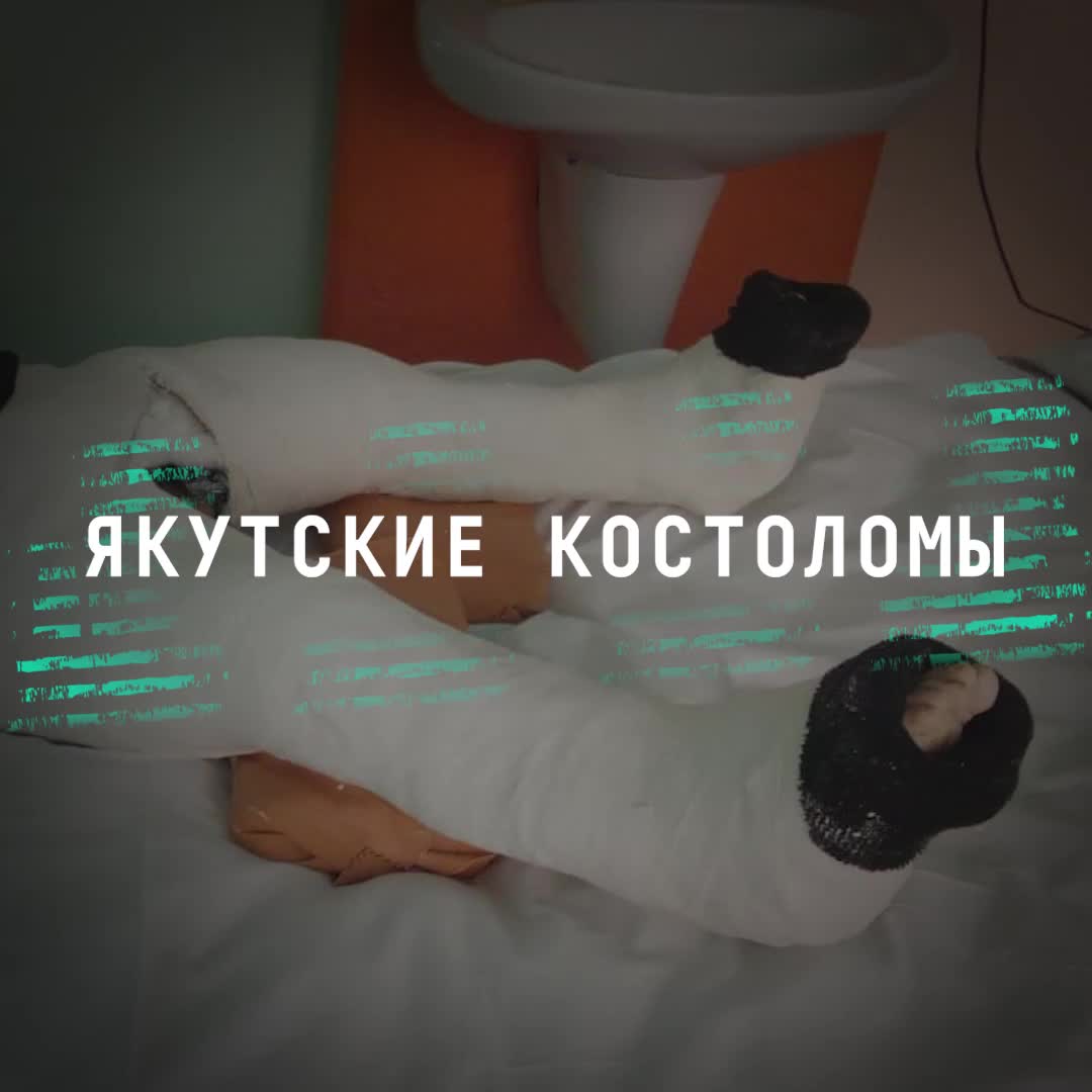 В Якутске родители требуют проверки после травм детей в детском саду и реабилитационном центре