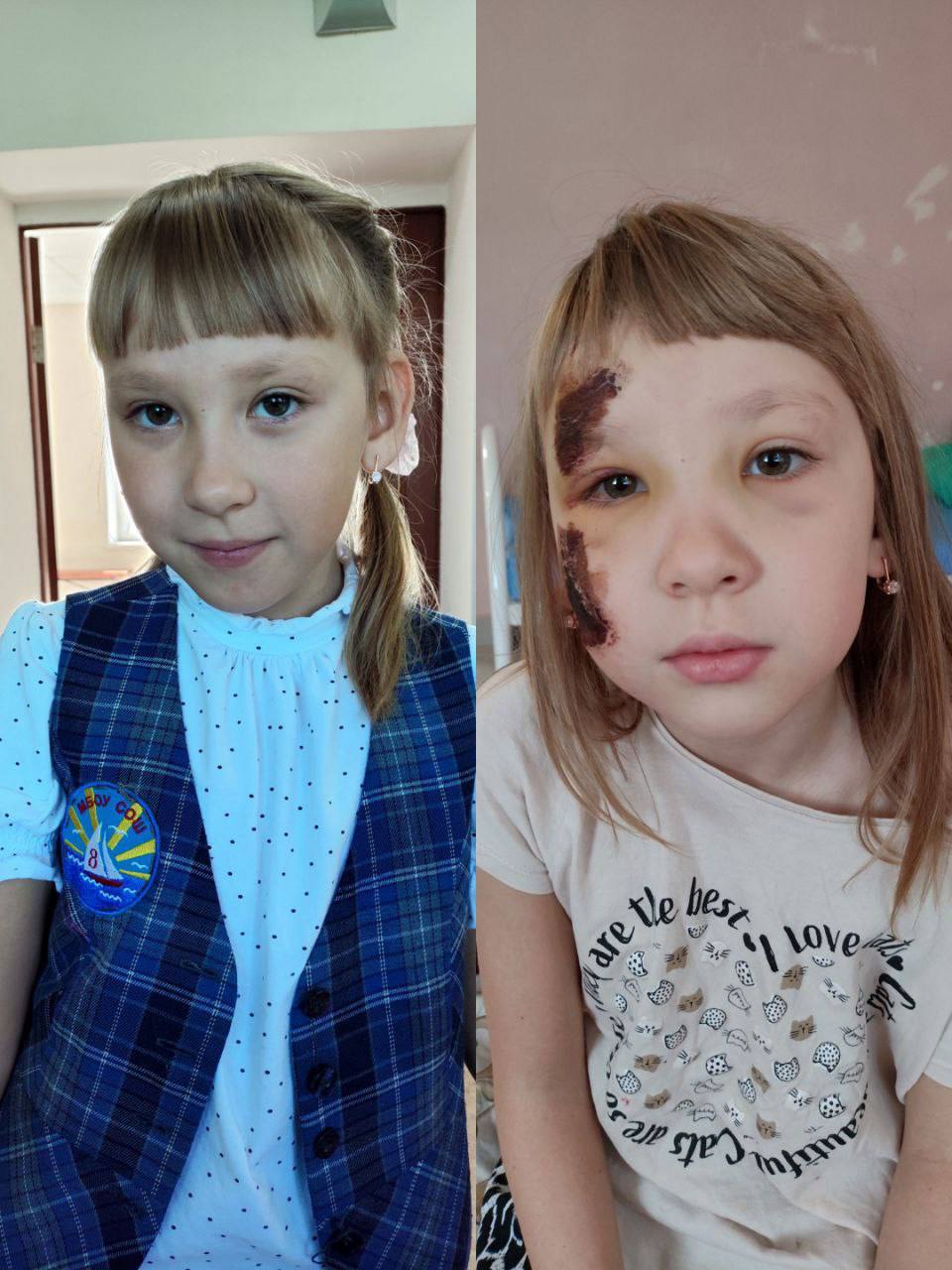 Совершенно дикая история о том как водитель в Самаре сбил ребёнка и отделался штрафом за проезд на красный сигнал светофора Подробности в канале журналиста Алёны Воронцовой новости Самара самарскиеновости ночнаясмена