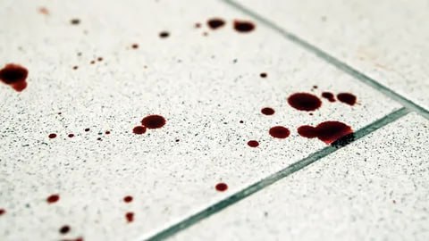 1 2 3 4 5 Полиция Анапы направила в суд дело о причинении тяжких телесных повреждений В ходе возникшего конфликта при распитии спиртных напитков женщина нанесла 2 ножевых ранения супругу. В Отдел МВД России по городу Анапе поступило сообщение из городской больницы о госпитализации мужчины с ножевыми ранениями. Сотрудники уголовного розыска задержали женщину на месте проживания. Задержанная пояснила, что в ходе конфликта в целях самообороны совершила удар двумя ножами в область груди. Испугавшись содеянного, она вызвала скорую помощь. В ходе осмотра места происшествия были изъяты 2 ножа. В отношении задержанной возбуждено уголовное дело по пункту «З» части 2 статьи 111 УК РФ «Умышленное причинение тяжкого вреда здоровью». Санкции статьи предусматривают наказание в виде лишения свободы на срок до 10 лет. Подозреваемой избрана мера пресечения в виде подписки о невыезде и надлежащем поведении. Полиция Анапы Вконтакте Одноклассники Rutube Дзен