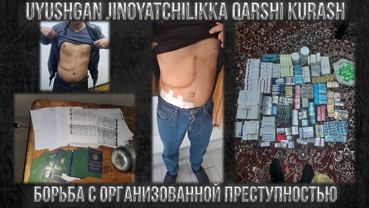 В Узбекистане раскрыта организованная преступная группа по продаже человеческих органов Об этом сообщает UzA Сотрудники СГБ и МВД задержали организованную преступную группу из 12 человек которая занималась торговлей органами и тканями В Ташкенте а также в Ферганской Бухарской и Кашкадарьинской областях злоумышленники через соцсети находили больных с тяжёлыми заболеваниями печени и почек а здоровых граждан за большие деньги уговаривали продать свои органы Подделывая документы и выдавая доноров за родственников они отправляли людей на операции в частную клинику соседней страны Только за 2023 2025 годы было проведено 32 пересадки почки и печени Деньги от пациентов частично уходили на оплату операций и доноров остальное участники делили между собой Более того тех кому операции не помогли они вынуждали покупать у них сильнодействующие лекарства по завышенным ценам По данному факту возбуждено уголовное дело материалы уже направлены в суд Tashkent Land