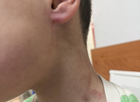 Тренер нанес травмы воспитаннику детсада в Иркутском районе возбуждено дело Следователи полицейские и сотрудники прокуратуры разбираются в случившемся Читать подробнее на сайте