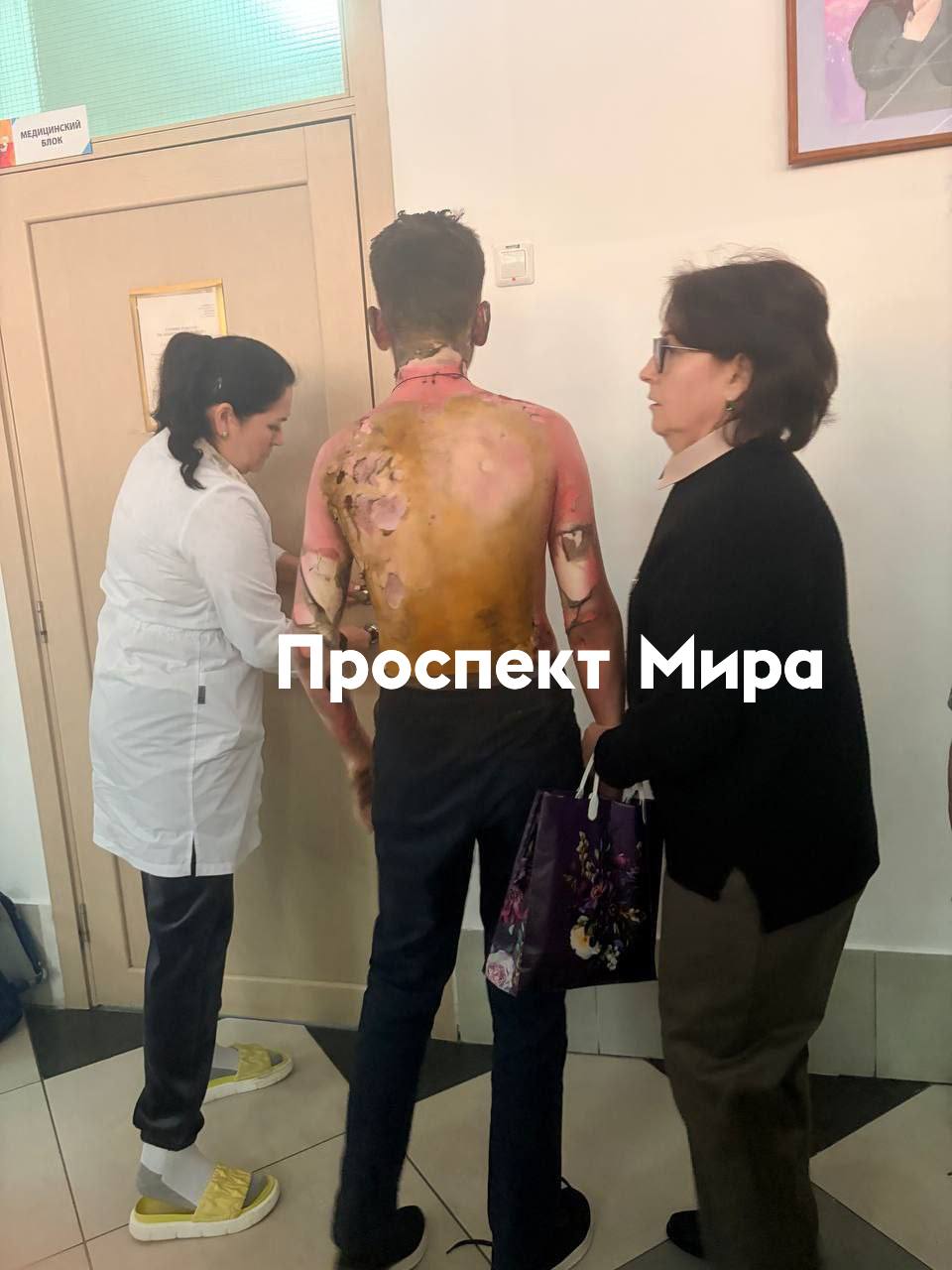 Школьники сообщают что восьмиклассница пронесла в туалет бутылку с бензином облила сверстника и подожгла Затем взяла молоток и напала на других Парня потушили сотрудники школы у него ожоги спины лица и конечностей Одежда сгорела prmira news