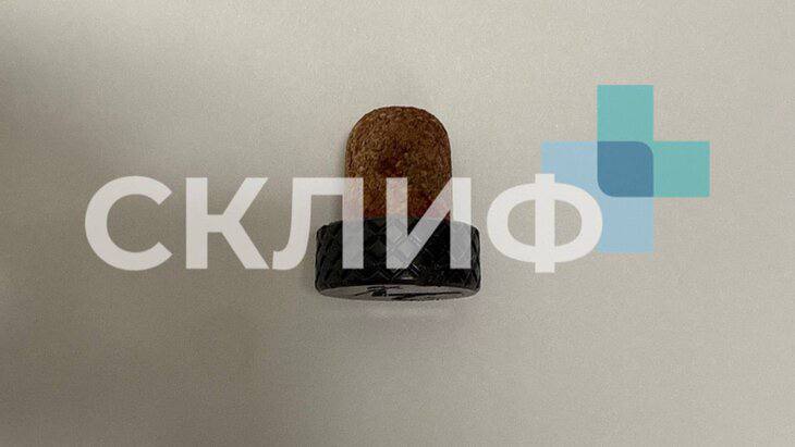 Врачи спасли мужчину с пробкой в груди Москвич катался на снегоходе с бутылкой коньяка под курткой При падении пробка пробила грудную клетку и застряла рядом с лёгким Врачи НИИ имени Склифосовского провели операцию удалили пробку и зашили повреждённые ткани Алкогольный экстремал провёл в больнице 5 дней и уже выписался пообещав больше так не рисковать Фото и информация Москва 24