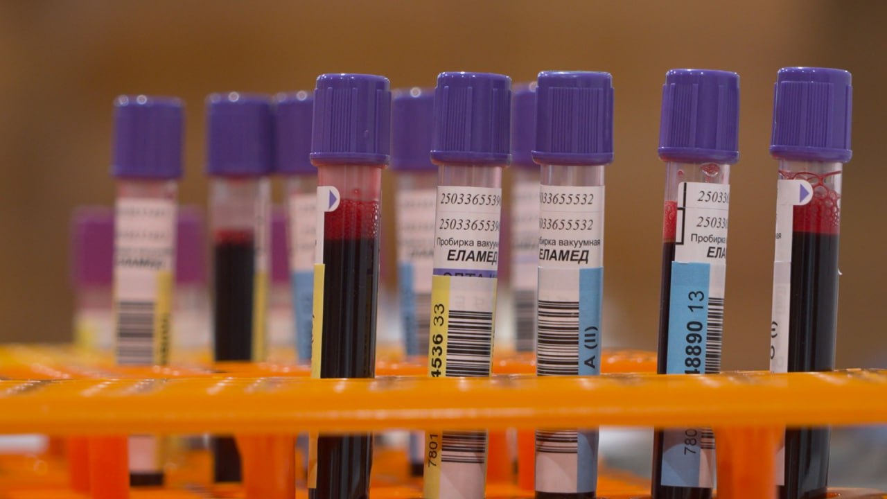 Невская ратуша стала площадкой для проведения Дня донора Ее участниками стали более 100 человек из числа молодых представителей исполнительных органов власти Петербурга Кроме сдачи кровь каждый желающий мог пополнить Федеральный регистр доноров костного мозга Акцию День донора проводит комитет по молодежной политике совместно с Городской станцией переливания крови и Национальным центром скорой помощи с 2013 года За это время в ней поучаствовали более 10 тысяч человек которые сдали порядка 7000 литров крови Фото скриншот с видео Город Подпишись на Город