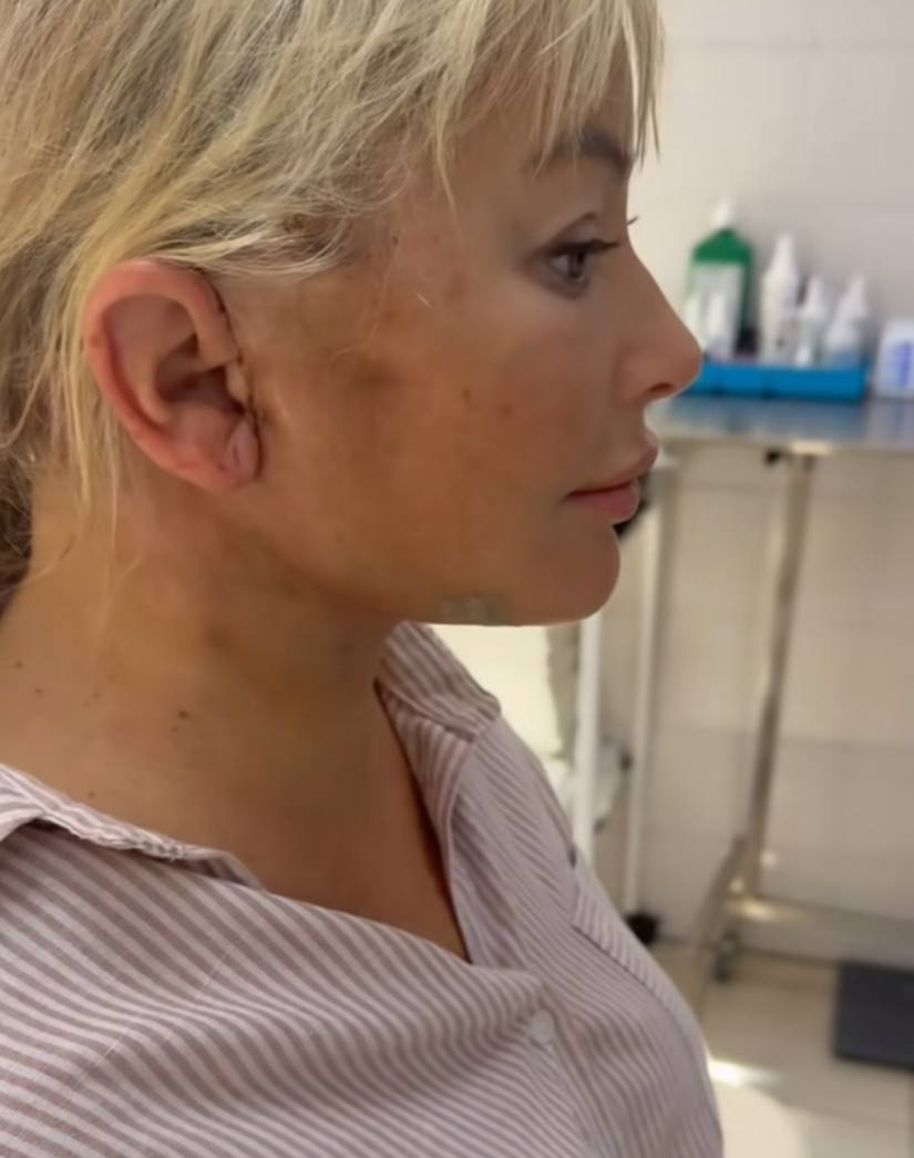 Дана Борисова показала результаты после операции по омоложению: