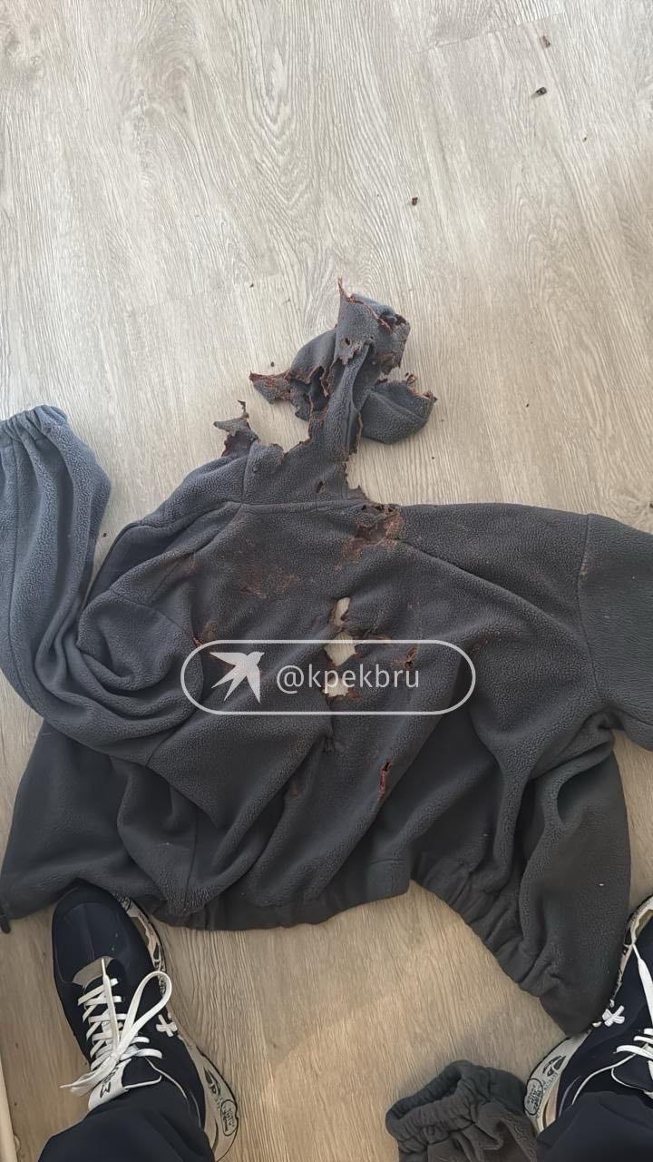 Бывший муж екатеринбурженки которую облили кислотой ответил на обвинения По словам Николая в момент нападения он ехал с сыном в школу Ребенок позвонил маме чтобы спросить заберет ли она его Она ответила что её две минуты назад облили кислотой Отец с сыном развернулись и поехали к Алене Когда они добрались до неё её уже забрали на скорой Я с ней не ссорился Я её безумно любил Мы с ней 17 лет жили Я ее не выгонял никогда не обижал рассказал КП Екатеринбург Николай Я не ожидал такого предательства Сейчас женщины классные хорошие но самые циничные люди Мужчина предполагает что нападение могла организовать подруга Алены По его словам его бывшая жена имела с её мужем романтическую связь Женщина узнала об этом и могла отомстить Алене На фото то что осталось от кофты в которой была Алена когда её облили кислотой   Подпишись на КП Екатеринбург Мы в Max