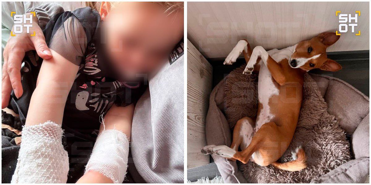 В Мурманске 2-летней девочке потребовалась операция после укуса басенджи 2-летнюю мурманчанку прооперировали после нападения домашней породистой собаки басенджи, сообщает SHOT. Африканская нелающая собака живёт в семье уже несколько лет и прекрасно ладит со старшим ребёнком. Однако с рождением малышки она стала более агрессивной. Когда девочка протянула собаке лакомства, та, видимо, сочла это попыткой её схватить и уцепилась ребёнку в руку. В больнице девочке обработали рану и назначили антибиотики, однако это не помогло. Из-за нагноения ткани начали отторгаться и малышке потребовалась операция. Собаку отдали на передержку, ей ищут новых хозяев в семье без детей.