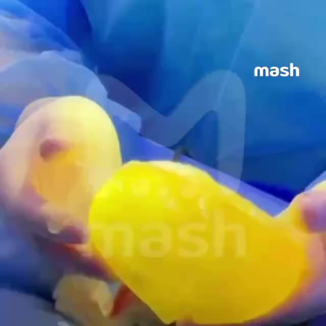 Инцидент с взрывом импланта у блогерши из Уфы во время тренировки