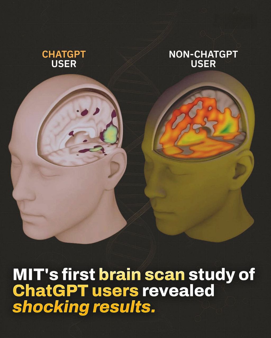 Массачусетский технологический институт MIT изучил влияние ChatGPT на мозг пользователей 83 3 респондентов не могли вспомнить ни одно предложение которое они написали всего несколько минут назад В отличие от них те кто писал без использования AI легко вспоминали свои работы Связь нейронов у пользователей ChatGPT резко снизилась с 79 до 42 баллов что составляет снижение на 47 в нейронной активности Это был самый низкий показатель среди всех групп После прекращения использования ChatGPT в последующих сессиях эти испытуемые продолжали показывать пониженную активность Их показатели оставались ниже чем у тех кто никогда не использовал AI Эссе написанные с помощью AI были технически правильными но часто назывались роботизированными без души и лишенными глубины Парадокс заключается в том что ChatGPT делает пользователей на 60 быстрее в выполнении задач но при этом снижает умственные усилия на 32 Лучшие результаты показали те кто работал без AI и начал использовать его позже У этих людей были выше показатели памяти активности мозга и общие результаты Вывод исследования заключается в том что ChatGPT может быть полезным инструментом но важно использовать его осознанно AI должен помогать а не заменять ваше мышление banksta
