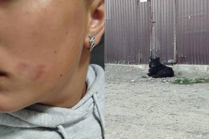 Безнадзорная собака напала на 13-летнюю школьницу в Иркутском районе. Домой девочка вернулась в слезах с расцарапанной рукой, грудью, спиной и лицом. Родители вызвали скорую. СК по Иркутской области завёл уголовное дело по статье о халатности. Все обстоятельства произошедшего выясняются. Подписаться Прислать новость