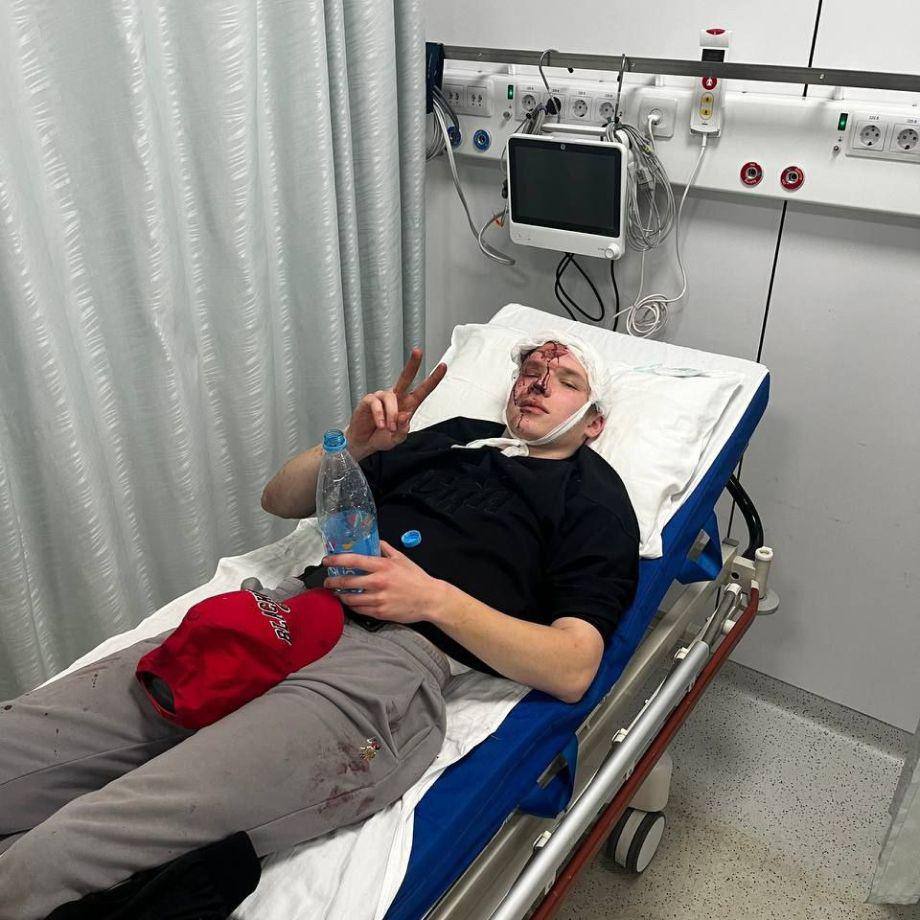 Бывшему хоккеисту из системы СКА Василию Малышеву выстрелили в голову из сигнальной ракетницы в Санкт-Петербурге. Всё произошло около компьютерного клуба «Колизеум» несколько дней назад. 19-летний Малышев приехал туда, чтобы встретиться с человеком, который задолжал ему денег. Однако, должник приехал не один, а с целой группой поддержки. Уже на месте они начали говорить Василию, что ему никто ничего не должен. Парень усмехнулся. После этого начался конфликт, который перерос в избиение Василия. Мы все выходим. Они начинают мне говорить, что этот человек мне ничего не должен. Я посмеялся над этим. Кто-то мне выкрикнул: «Чё ты лыбишься?» Обозвал меня как-то. Я ему сказал: «Рот закрой свой», — и понеслась. Мутузили, мутузили, потом выстрелили из сигнальной ракетницы вплотную в голову - рассказал Василий «Чемпионату». Малышева госпитализировали в местную больницу — там у него диагностировали закрытую черепно-мозговую травму, сотрясение мозга, ушибленную рану теменно-височной области и термический ожог плеча.