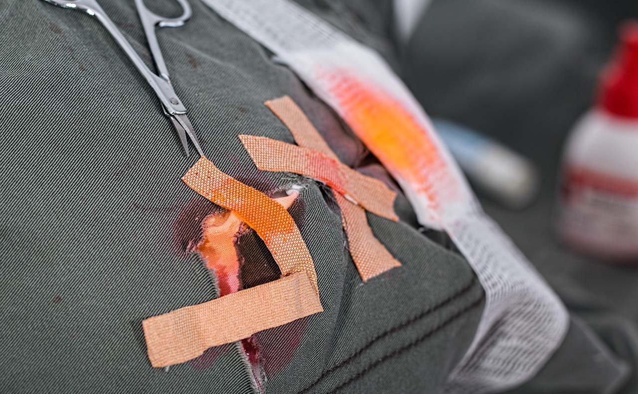 Жителю Камчатки заплатят за травму на производстве Прокуратура провела проверку по факту травмирования работника на производстве Выяснилось что в июне 2024 года 48 летний бригадир прибрежного лова получил серьёзную травму руки при постановке невода Подробности по ссылке   kamtime ru article 2a43c438 751a 4c96 8e73 d4eac024567e