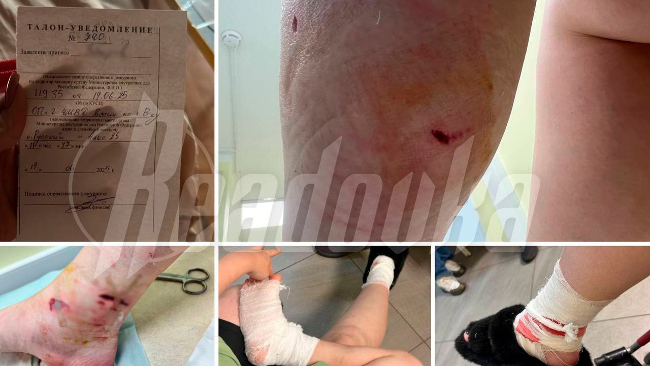 Во Владивостоке на мать с двумя детьми прямо в подъезде отец дворового хулигана натравил бультерьера  Во Владивостоке мама с двумя детьми 4 и 8 лет решила обсудить поведение мальчика, который задирает всех ребят во дворе, и пришла домой к родителями хулигана. Дверь открыл пожилой мужчина и вместо диалога, по словам женщины, дал команду «фас» своей бойцовской собаке. Бультерьер набросился на 4-летнего ребенка, мать кинулась собой закрывать сына. В итоге и женщина, и малыш получили травмы. Хозяин пса стал оттаскивать агрессивное животное только после того, как услышал шаги соседки.  Как рассказала Readovka пострадавшая мама, мальчик получил только один укус, весь удар она приняла на себя. Пережитый стресс сильно сказался на ее младшем ребенке — он плохо спит и часто плачет. Женщина же страдает от сильных болей и не может нормально передвигаться из-за отека и ран. Хирург сказал ей, что улучшений пока нет. Хозяин собаки утверждает, что мама с детьми сама пришла к нему домой и открыла дверь, поэтому пес напал. Правоохранители проводят проверку по данному нападению и устанавливают обстоятельства произошедшего.