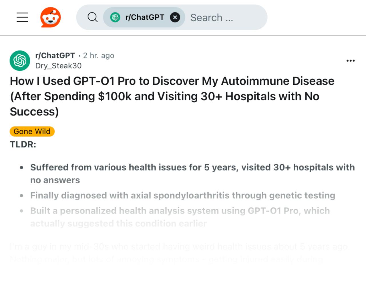 У парня с Reddit в 25 лет начались странные проблемы: усталость, травмы на ровном месте, боль, из-за которой он едва ходил. 5 лет, 30 больниц, $100,000 на врачей и анализы — но никто не мог найти причину.  Тогда он загрузил свои симптомы и медкарты в GPT-O1 Pro — нейронка сразу назвала верный диагноз, который позже подтвердили врачи с помощью генетического теста.  ждём в ДМС подписку на GPT