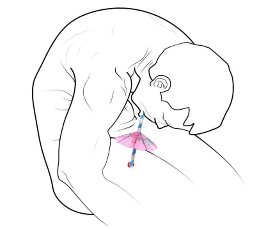 Подросток отравился выпив свою кровь по совету из тиктока пишет Shot 17 летний москвич хотел таким образом поднять уровень гемоглобина но в итоге у него началась рвота и поднялась температура теперь его направили к психиатру А что ещё случилось