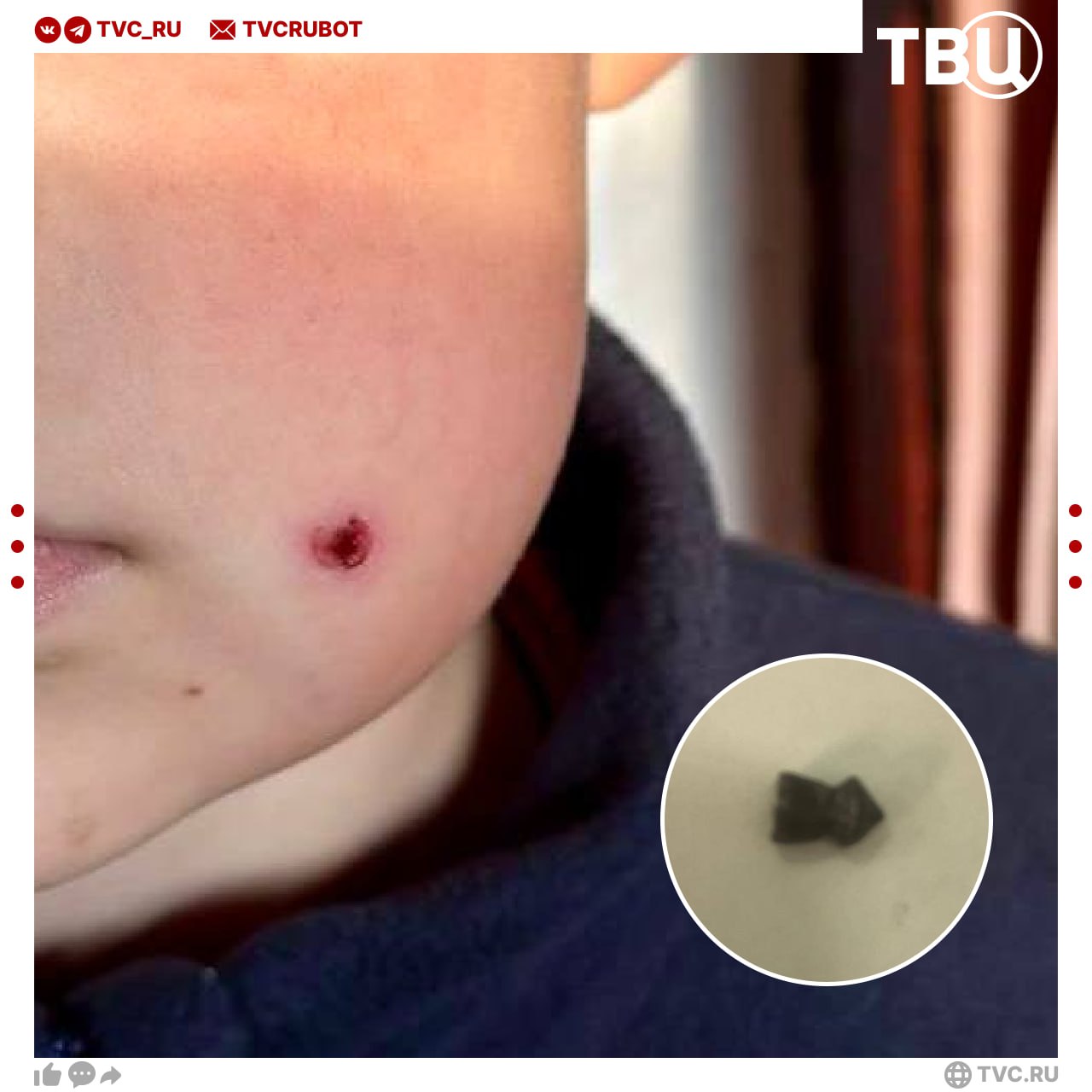 Неизвестный выстрелил из пневматического ружья в лицо 9 летнего мальчика в Туапсе Пуля попала в щеку ребенка его госпитализировали Мальчик говорит что не видел стрелявшего Полиция его ищет Подписаться на ТВЦ в MAX