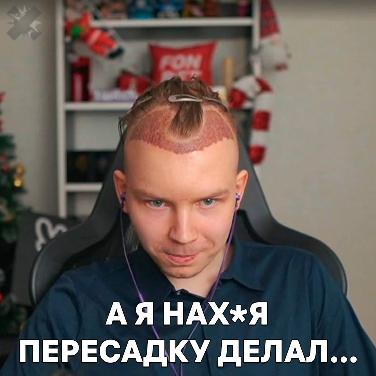 Наука против лысины новый препарат отращивает волосы на 500 за полгода Лосьон действует точечно на фолликулы без побочек для организма Пятикратный рост на проблемных зонах Появление в аптека и снижения числа скуфов в Турции ожидается уже к концу 2026 го   наука творит чудеса Зубарев ты читаешь это НМШ