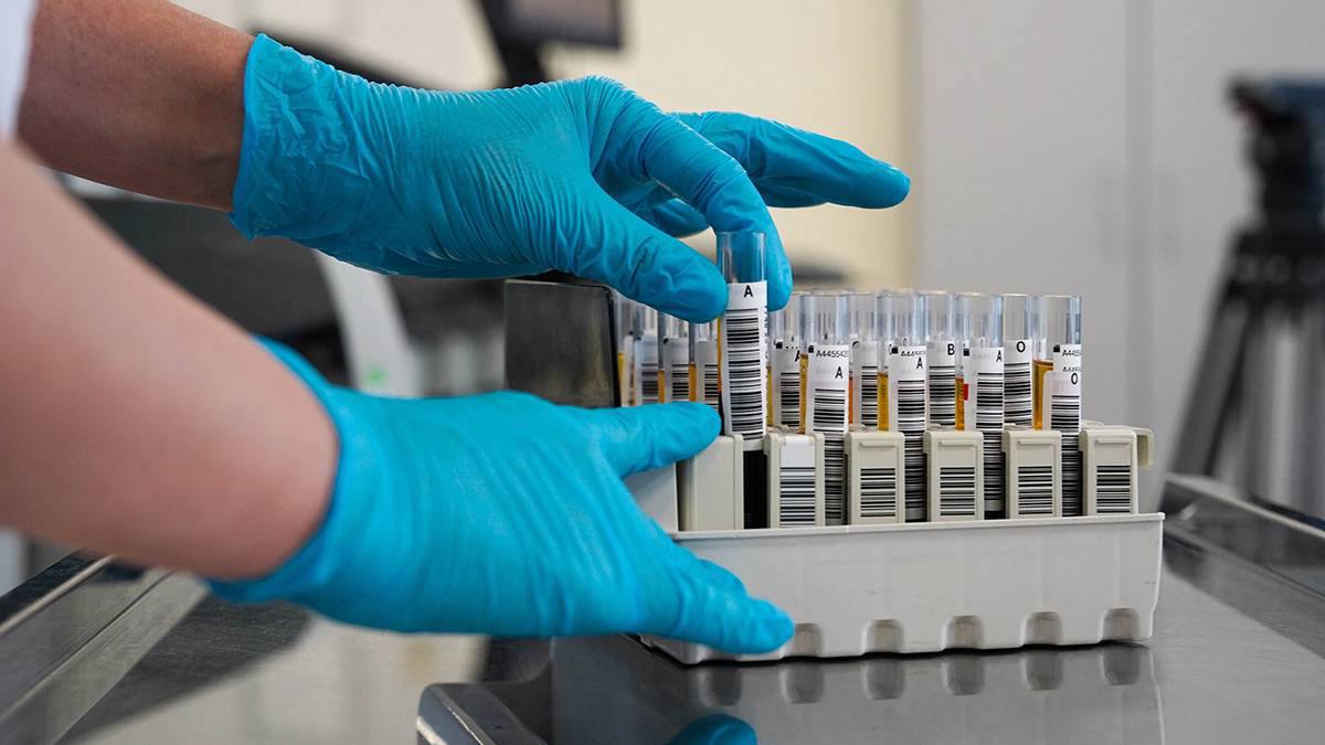 Анализ на ВПЧ стал доступен для россиянок по ОМС Диагностика вошла в первый этап диспансеризации для женщин 21 49 лет ВПЧ это тихий убийца который передается половым путём и вызывает появление бородавок папиллом и злокачественных опухолей Кроме того вакцина от ВПЧ скоро станет бесплатной уже с 2027 года прививку включат в национальный календарь вакцинации Фото АГН Москва