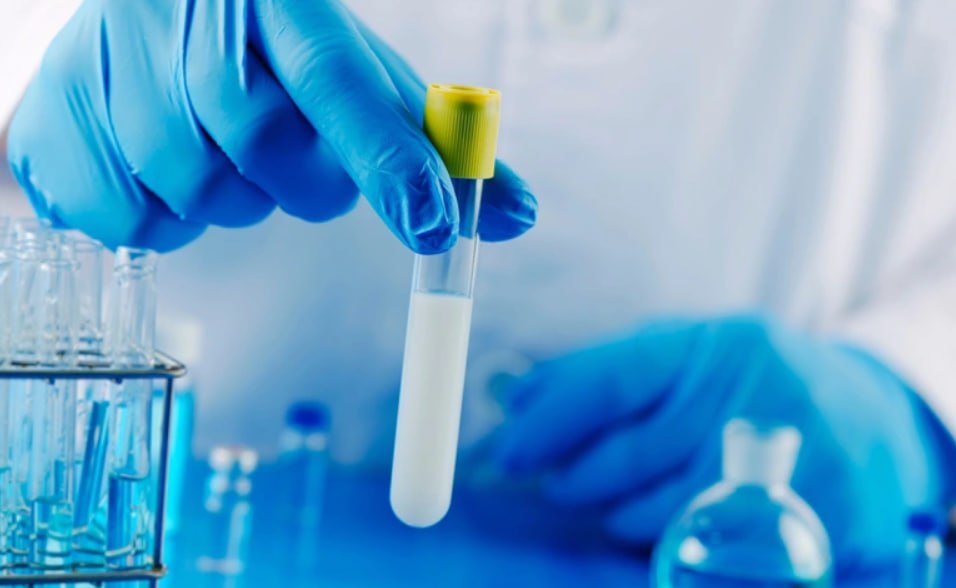 Донор спермы оказавшийся носителем мутации в гене TP53 приводящей к раку стал отцом как минимум 197 детей в нескольких странах Европы Некоторые из них уже унаследовали мутацию и заболели есть и смертельные случаи рака говорится в расследовании журналистской сети Европейского вещательного союза куда входят ведущие СМИ европейских стран Подробности публикуют в том числе датское радио и шведское телевидение В 2005 году датский студент стал донором в Европейском банке спермы ESB базируется в Копенгагене одно из крупнейших учреждений в мире такого рода номер 7069 и псевдоним Кьельд На тот момент ни он ни ESB не знали о наличии мутации Позднее в 10 19 сперматозоидов Кьельда выявлена мутация в гене TP53 Он выполняет функцию супрессора механизма подавления образования злокачественных опухолей и еще называется антионкогеном Мутации в TP53 обнаруживаются в клетках около половины раковых опухолей Сам Кьельд как считается остается здоровым будучи просто носителем однако мутация при передаче потомкам значительно повышает риск возникновения онкологических заболеваний в детстве таких как лейкемия опухоли мозга и рак костной ткани Фото Shutterstock РБК в Telegram и MAX