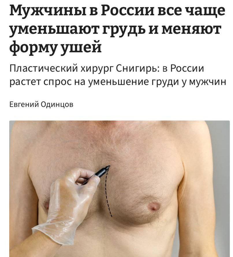 В России мужчины массово обращаются к пластическим хирургам чтобы уменьшить грудь это один из самых популярных запросов отмечают врачи Часто проблему списывают на лишний вес но когда это не помогает мужчины выбирают более радикальный способ Кроме того среди востребованных процедур у мужчин коррекция ушей Прямой эфир Наш MAX