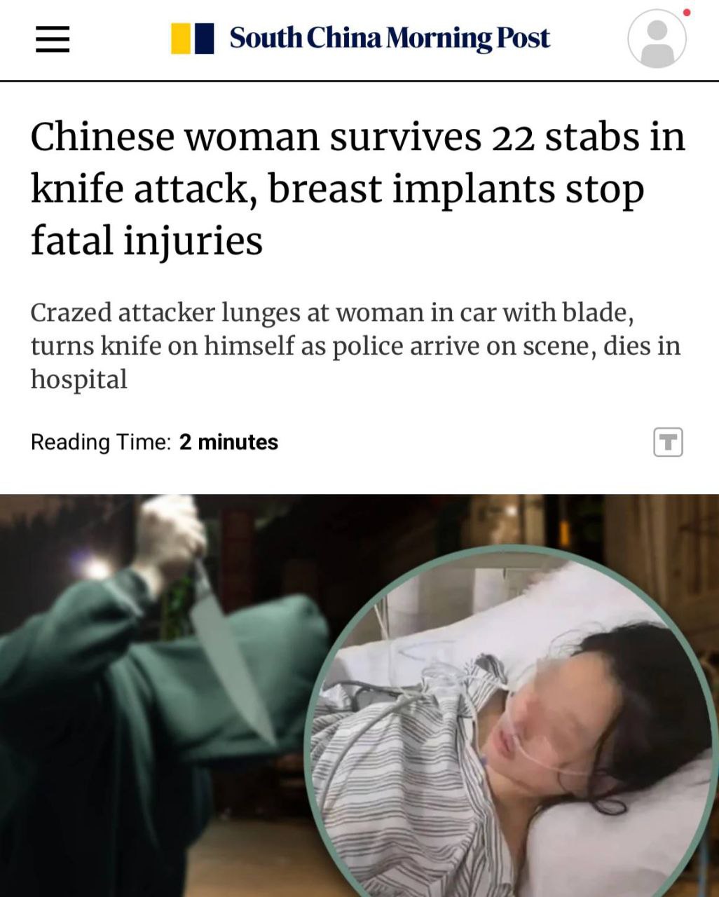 Силиконовая грудь спасла китаянку от смерти, пишет SCMP. Импланты выдержали 22 ножевых и стали щитом для сердца. Незнакомец сел к ней в машину и потребовал отвезти его в другой город, а после отказа напал. Девушка получила серьёзные ранения. Врачи заявили, что силикон заблокировал смертельный удар, который мог достать до сердца и лёгких. Сейчас китаянка идёт на поправку Прямой эфир