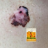 Аватар Телеграм канала: Дерматология. Полезное