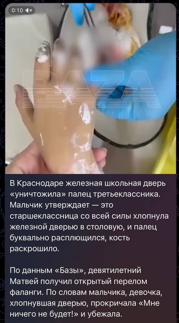 В краснодарской школе мальчик получил перелом пальца В соцсетях появилось сообщение что в одной из школ Краснодара старшеклассница случайно прищемила руку младшему ученику железной дверью У мальчика открытый перелом пальца Пользователи пишут что руководство школы не отреагировало на инцидент Следственный комитет начал проверку Назначена судебно медицинская экспертиза сообщили в СУ СКР по Краснодарскому краю Кубанские Новости Мы в MAX
