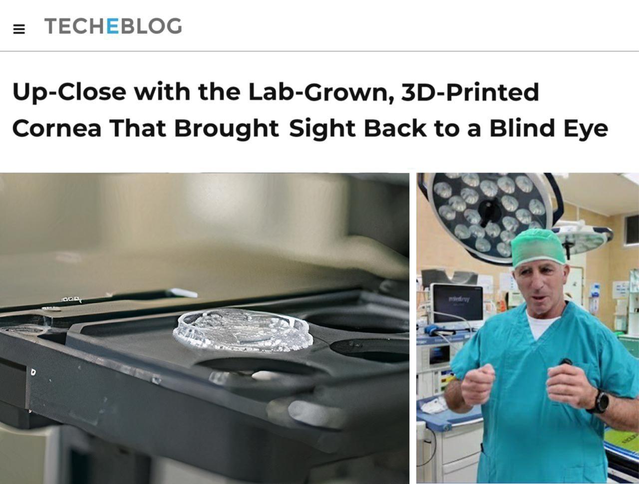 На 3D принтере напечатали часть глаза и вернули зрение 70 летней бабушке после лет в темноте это первая подобная операция в мире Врачи из Израиля напечатали из живых клеток роговицу глаза и пересадили её пациентке организм принял имплант без отторжения кто купил 3D принтер на хайпе не торопитесь продавать concertzaal