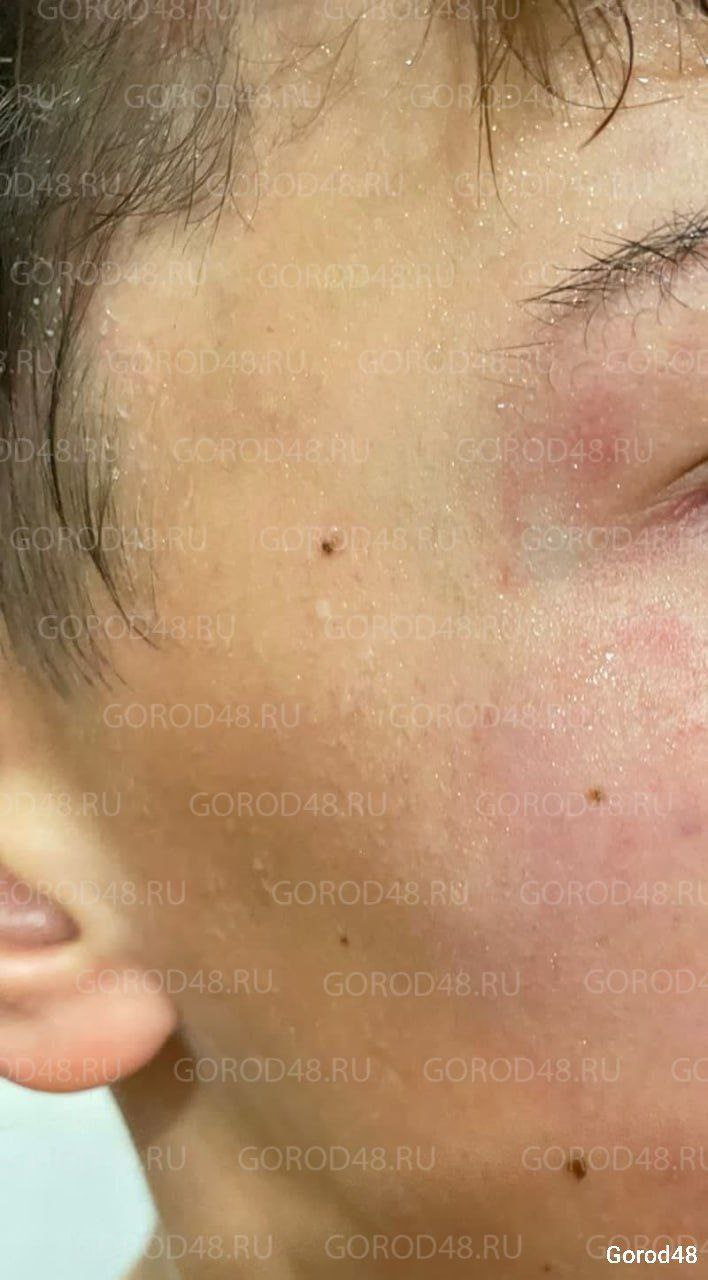 14 летний подросток попал в больницу с сотрясением мозга после нападения подростков на улице Циолковского 26 По словам Дмитрия отца пострадавшего около пяти вечера 4 ноября его сын с друзьями сидел в беседке Мимо прошла девушка которая сделала им замечание Позже она вернулась с компанией несовершеннолетних вооружённых газовым баллончиком и аварийным молотком Друзья убежали а сыну Дмитрия досталось Мальчик опознал обидчиков по видео с погромом клумбы на Циолковского где несовершеннолетние курят и ломают клумбу 90 летней бабушки Сотрудники ПДН нашли нападавшего это та же компания которая разгромила палисадник В отношении родителей подростка 2010 года рождения составлен протокол о неисполнении родительских обязанностей Полицейские дадут правовую оценку действиям юноши Подпишись на Липецк 1