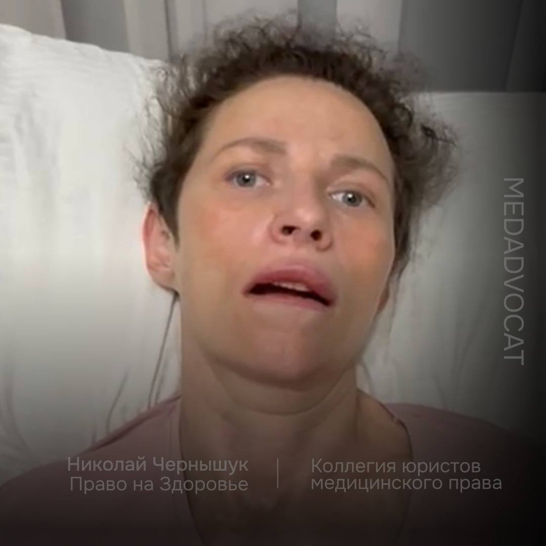 Суд вынес решение по делу Юлии Манукян: 1 000 000₽ компенсации морального вреда Юлия мечтала стать мамой. Обратилась за помощью к гинекологу, которая отправила ее к своему супругу чтобы сделать рассечение спаек в брюшной полости. Девушке провели лапароскопическую операцию во время которой повредили кишечник, начался перитонит и сепсис, заражение крови. Девушке экстренно провели операцию по ушиванию дефекта. Во время подготовки Юле поставили подключичный катетер, и пробили легкое, заметили это не сразу, потому что не сделали полагающийся рентген грудной клетки. Экспертиза по уголовному делу из Краснодарского главного бюро судебной экспертизы показала, что никто ни в чем не виноват, всё сделали правильно. Обратившись в суд с гражданским иском, была проведена экспертиза которая установила прямую причинно-следственную связь. Больница настаивала, что разрыв кишечника мог произойти при натуживании, и что деньги придется забирать у других пациентов. Суд назначил компенсацию в один миллион рублей. Вряд ли суд понимает, что даже сама необходимость операции вызывает сомнения, возможно врач просто хотел заработать и делал ненужные операции по направлению жены, сейчас это уже невозможно доказать. Никто не понесет уголовного наказания, врач продолжает работать. Он отказался принимать участие в суде, отказался обсуждать случай по телефону. Муж Юлии ушел, мама осталась один на один с проблемой ухода за дочерью. Она уже продала дом, все деньги идут на лечение и восстановление. Маме 70 лет, что будет с Юлией, когда закончатся деньги, когда мамы не станет? Мы провели работу по сбору доказательств, представляли интересы в контролирующих организациях, подготовили вопросы на судебную экспертизу, активно взаимодействуем со следственными органами, судебное разбирательство длилось год, все это время мы участвовали в судебных заседаниях, подавали ходатайства, отстаивали свою правовую позицию, доказывая право на компенсацию. Сейчас мы планируем обжаловать решение суда, также в рамках уголовного дела подали ходатайство о проведении повторной экспертизы. Шансов на справедливость мало, мы делаем всё, чтобы добиться правды, работаем дальше. __________ Чернышук Николай Медицинский юрист «Право на Здоровье» - защищаем пациентов при некачественном оказании медицинской помощи