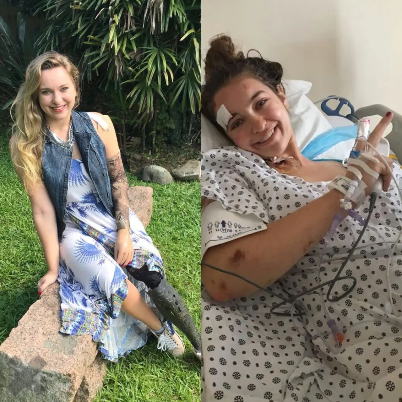 Компенсация века 6 4 млрд руб 82 млн за руку и ногу Бразильская студентка потеряла сознание и упала под поезд она потеряла руку и ногу после чего обратилась в суд Десятилетний процесс завершился тем что присяжные решили городские транспортные власти не внедрили нужные меры безопасности Суд Бруклина постановил выплатить ей огромную сумму сообщает New York Post сколько денег жуткая история НМШ