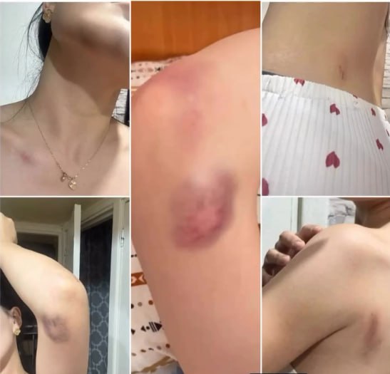 В Кара-Балте мужчина избил девушку в магазине По словам пострадавшей, конфликт начался на межнациональной почве. «Мы с другом зашли за покупками. Незнакомый мужчина спросил у моего друга, кто он по национальности. Тот ответил, что уйгур. После этого мужчина начал оскорблять меня, называя проституткой за то, что я общаюсь с уйгуром. Я не выдержала и дала ему пощечину. Мы решили уйти из магазина, но жена того мужчины схватила меня за волосы, а потом ее муж несколько раз ударил меня кулаком по лицу», — рассказала девушка. Она добавила, что после происшествия с другом пошла к машине, но поняла, что потеряла телефон в магазине. Когда ее друг вернулся, женщина осталась в авто. В этот момент мужчина подошел, начал бить по стеклу автомобиля, открыл дверь и снова ударил ее. Девушка выбежала из машины и побежала по дороге, а мужчина побежал за ней, но прохожие остановили его. Всех участников конфликта доставили в милицию. По словам нападавшего, женщина якобы украла у его жены золотую цепочку. Он потребовал с нее компенсацию в размере 30 тысяч сомов. В настоящее время ведется разбирательство по факту происшествия.
