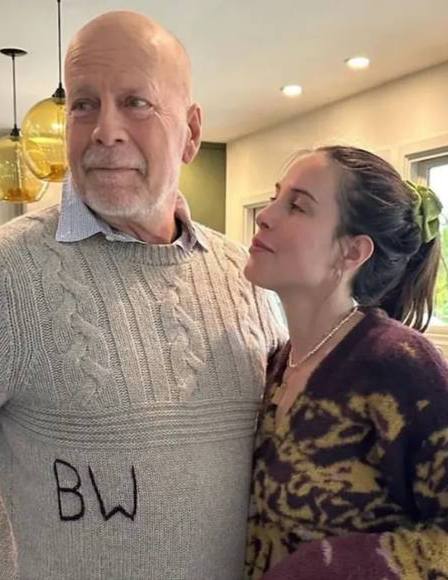 Семья Брюса Уиллиса решила передать мозг актера ученым после его смерти Этот шаг станет частью исследований которые направлены на изучение лобно височной деменции Это может однажды помочь другим семьям объяснила супруга актера ВПШ