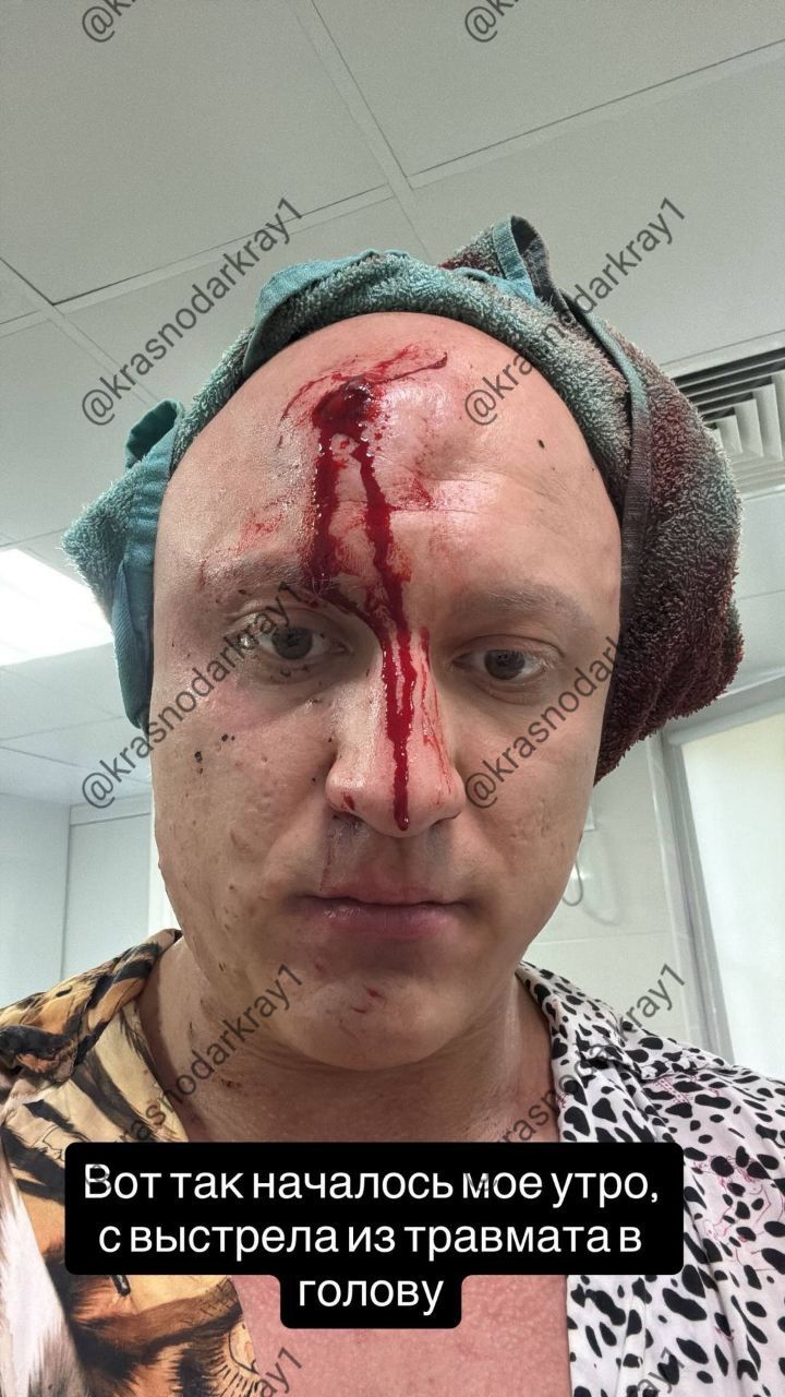 В Краснодаре мужчина получил пулю в лоб после конфликта в ночном клубе. Двое мужчин подошли к Владиславу на улице Красной и не с того ни с сего попросили дать им наркотики, после чего начался конфликт и погоня на машинах. Погоня закончилась стрельбой на улице Ягодина и ранением Влада в лоб, ему потребовалась операция. Полиция официально не комментирует произошедшее, предположительно возбуждено уголовное дело. Стрелявшие не задержаны. Ваши видео высылайте нам в бот Подпишись поделись Прислать видео новость