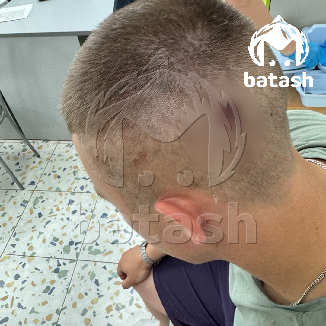 17-летний охранник ! клуба "New Проспект" в центре Уфы получил пулю в голову. Заведение находится на гостинке. Парень устроился подрабатывать на лето, но в начале июля всё пошло наперекосяк. К клубу пришла пьяная компания. Внутрь неадекватную четвёрку не пустили, за это один из гостей достал травмат. Пуля прилетела подростку в затылок. Выжил, но почти месяц лежал с сотрясением. Родные до сих пор не верят, что всё обошлось. Следователи возбудили дело за угрозу убийством. Адвокат просил изменить статью на "Покушение на убийство" или хотя бы "Хулиганство". Но говорит, что в МВД всем всё равно. Мы запросили комментарий у полицейских.