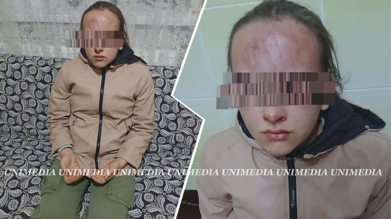 Кошмар в Яловенах 13 летнюю девочку избили два подростка пока мальчики снимали происходящее на видео её пытались утопить в овраге ℹ  В одном из населённых пунктов Яловенского района произошёл крайне тяжёлый инцидент 13 летняя девочка стала жертвой жестокого нападения со стороны двух подростков в то время как несколько мальчиков наблюдали за происходящим и снимали всё на видео сообщают источники UNIMEDIA ℹ  По их данным нападавшие девочки примерно 15 лет пришли разобраться с жертвой ученицей 7 го класса из за конфликта Агрессия быстро переросла в жестокое избиение а в какой то момент подростки попытались утопить девочку в местном овраге ℹ  На видеозаписях с места происшествия видно как девочка стоит на коленях и умоляет отпустить её домой В результате избиения она получила тяжёлые травмы перелом руки трещину носовой кости и перелом челюсти Подпишись на primulinmd