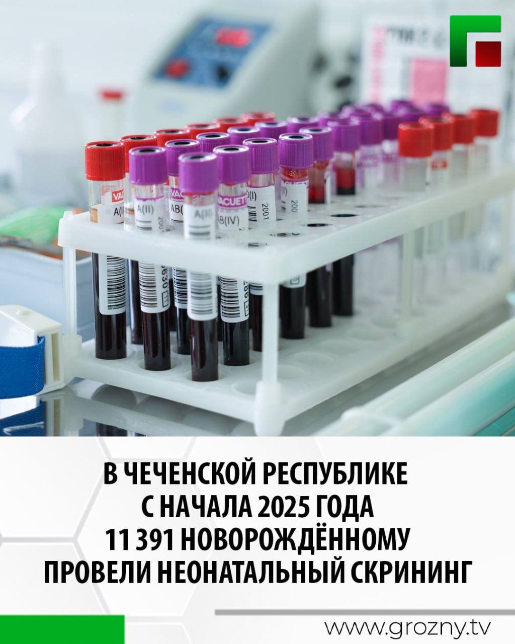 Обследование провели на выявление 36 наследственных и редких заболеваний в рамках расширенного неонатального скрининга. Это важная мера ранней диагностики, которая позволяет выявить тяжёлые генетические патологии ещё до появления первых симптомов, сообщает Минздрав ЧР. Скрининг проводится бесплатно благодаря национальному проекту «Продолжительная и активная жизнь». В перечень обследуемых заболеваний входят спинальная мышечная атрофия, первичные иммунодефициты и наследственные нарушения обмена веществ. Забор крови у новорождённых проводится в первые дни жизни — у доношенных детей на вторые сутки, у недоношенных — на седьмой день после рождения. Анализ выполняется в лаборатории Республиканского перинатального центра.