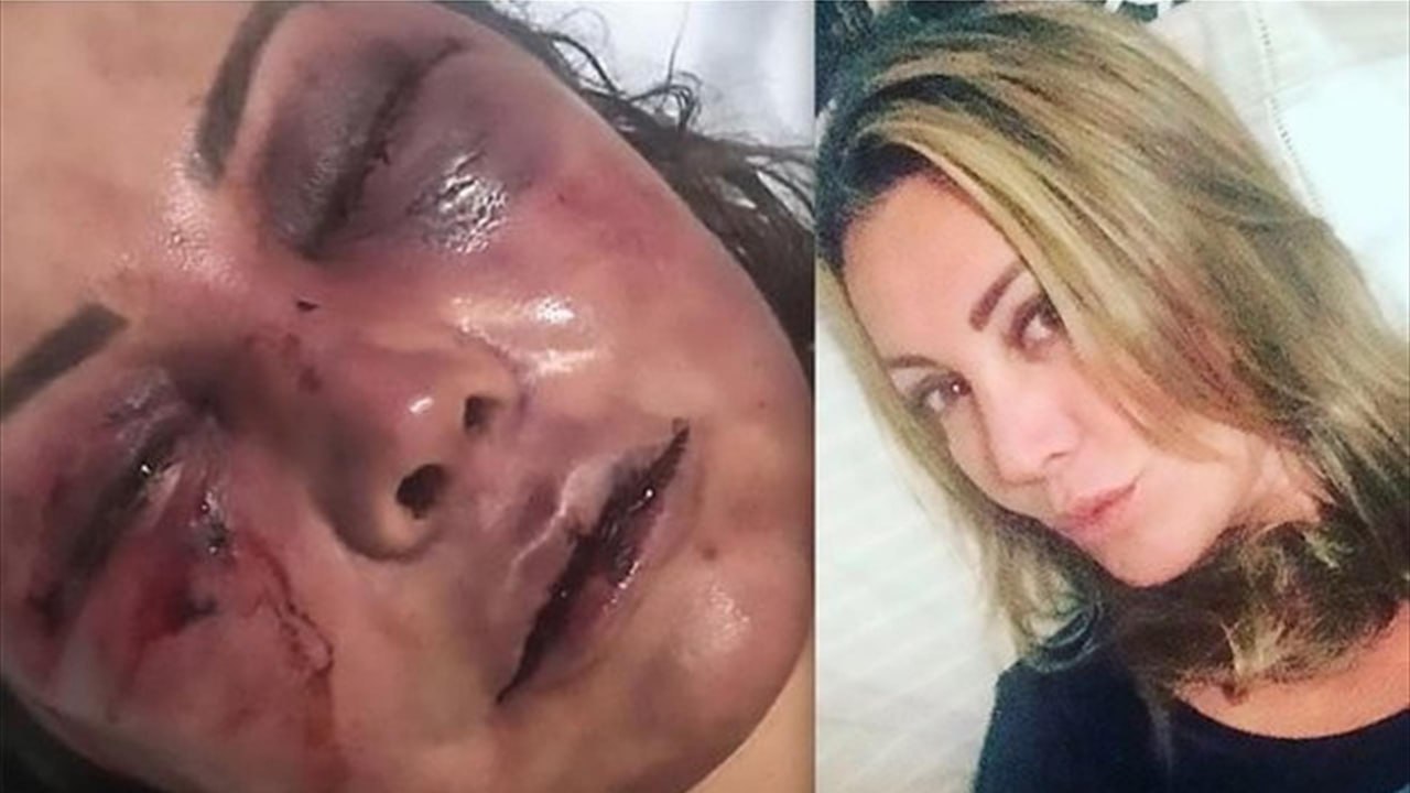 22 летняя девушка с тяжелейшими ранениями избежала украинского плена и попала на российскую территорию Утром 12 марта на восточном направлении наши парни обнаружили ее в 200 метрах от позиций РФ и смогли вывезти и спасти ее Как оказалось позже она пробыла 7 месяцев в плену у ВСУ где выживала в свинских условиях ежедневно терпя изнасилования пытки и наказания что подтверждают видео и фото которая она украла с собой перед побегом ФОТО И ВИДЕО ИЗДЕВАТЕЛЬСТВ В ПЛЕНУ Спасенная смогла передать точные координаты концлагеря фашистов так что уже 13 числа ночным штурмом позиции ВСУ были захвачены и еще 5 девушек вызволены Свыше 50 девушек были истерзаны и убиты не дождавшись помощи Сохраненные записи ВСУшников доказывают это только посмотрите как они поступали с нашими девчонками   t me gEn heuhXDNkYmE0