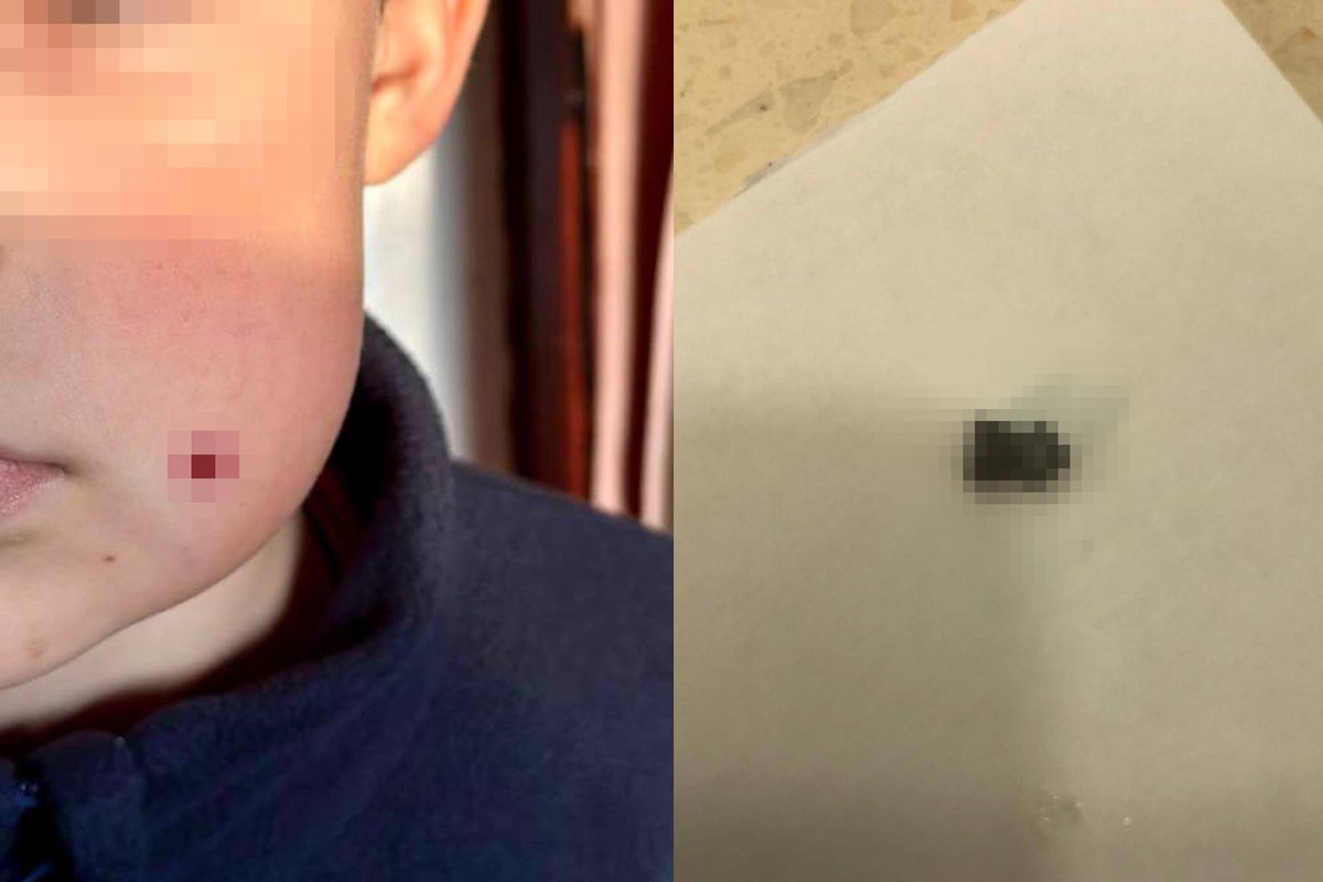 В Туапсе неизвестный выстрелил в 9 летнего мальчика из пневматики 23 ноября на улице Шаумяна 9 летний школьник получил ранение во дворе когда играл с другом Мальчик внезапно почувствовал удар в лицо пуля из пневматического оружия застряла в щеке В больнице ее извлекли хирургически ребенку наложили швы Его состояние стабильное скоро выпишут Стрелявшего пока ищут Полиция и прокуратура проводят проверку назначена судмедэкспертиза