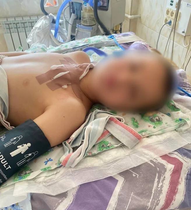 В Сочи медики спасли жизнь 10 летнего мальчика с тяжелой травмой шеи доставив его в больницу за 25 минут и проведя многочасовую операцию после четырех остановок сердца Об этом сообщил глава краевого минздрава Евгений Филиппов в своем Telegram канале Ребенок получил серьезные повреждения шеи и потерял много крови После поступления вызова бригада скорой помощи немедленно направилась к месту происшествия Сложность заключалась в том что адрес нового здания отсутствовал на картах Диспетчер дистанционно направлял медиков и одновременно инструктировал свидетелей как остановить кровотечение Через шесть минут врачи прибыли на место Фельдшер принял решение сразу транспортировать пострадавшего в детскую больницу не дожидаясь дополнительной бригады Полиция сопроводила машину с включенными спецсигналами врачи больницы подготовились к приему пациента От момента вызова до начала операции прошло 25 минут Через двое суток ребенок начал говорить функции мозга остались неповрежденными Сейчас пациент находится в обычной палате Telegram канал Евгений Филиппов Подписывайтесь на Ъ Сочи