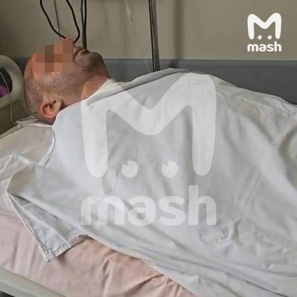 Медики госпитализировали туриста в Гелинджике после пожара на яхте "Баунти"  Мужчина находится в реанимации в тяжёлом состоянии.   В субботу яхта «Баунти», на которой катали туристов, находилась у понтонного причала на пляже «Сады морей». Во время заправки топливо вспыхнуло, и начался пожар. Сильно пострадал один из туристов Алексей. Его увезли в больницу с 70% ожогов тела.