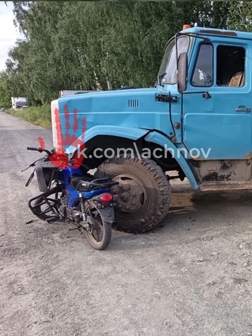 Переломал кости и разбил голову! Школьник на мопеде влетел в грузовик Авария произошла в Чебаркульском районе. По данным полиции, мальчику было всего 13 лет. Мопед он взял у брата. Разрешения не спрашивал. На дороге не справился с управлением. Молодой человек получил два перелома конечностей, рваные раны и черепно-мозговую травму. Его госпитализировали в больницу Чебаркуля. Все случилось 16 июня около 18:00. Юным нарушителем оказался житель поселка Тимирязевский. Катался он на мопеде марки "Райсер". Влетел в грузовик под управлением 56-летнего водителя.