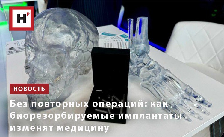 Ученые НИТУ МИСИС совместно с индустриальным партнером «Остео-Сайбэр» создали первую в России производственную площадку для выпуска биорезорбируемых магниевых имплантатов для челюстно-лицевой хирургии и травматологии. Преимущество металлоконструкций в том, что их не нужно удалять из организма, через некоторое время они растворяются. Разработанные магниевые сплавы обладают уникальными свойствами: биосовместимостью, оптимальными эксплуатационными свойствами. Инновационные методы изготовления заготовок позволяют регулировать скорость растворения материала. Благодаря тому что фиксирующая конструкция постепенно замещается костной тканью, исчезает необходимость в повторной операции. Компания «Остео-Сайбер» проявила интерес к разработке ученых и планирует производить из магниевого сплава 18 видов изделий для травматологии и 6 для челюстно-лицевой хирургии, включая винты, пины и пластины. Фото: пресс-служба НИТУ МИСИС Подробнее на портале Научная Россия #ниту_мисис #имплантаты