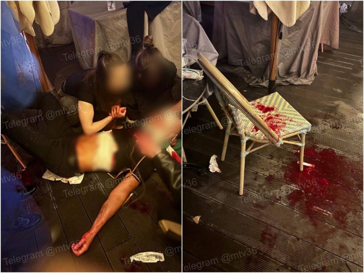 Полиция начала проверку после кровавых разборок на воронежской Советской площади По словам очевидцев, во время драки использовали нож. Пострадавшими оказались двое парней, а вот нападавшим удалось скрыться. ↗ Прислать новость Подписаться