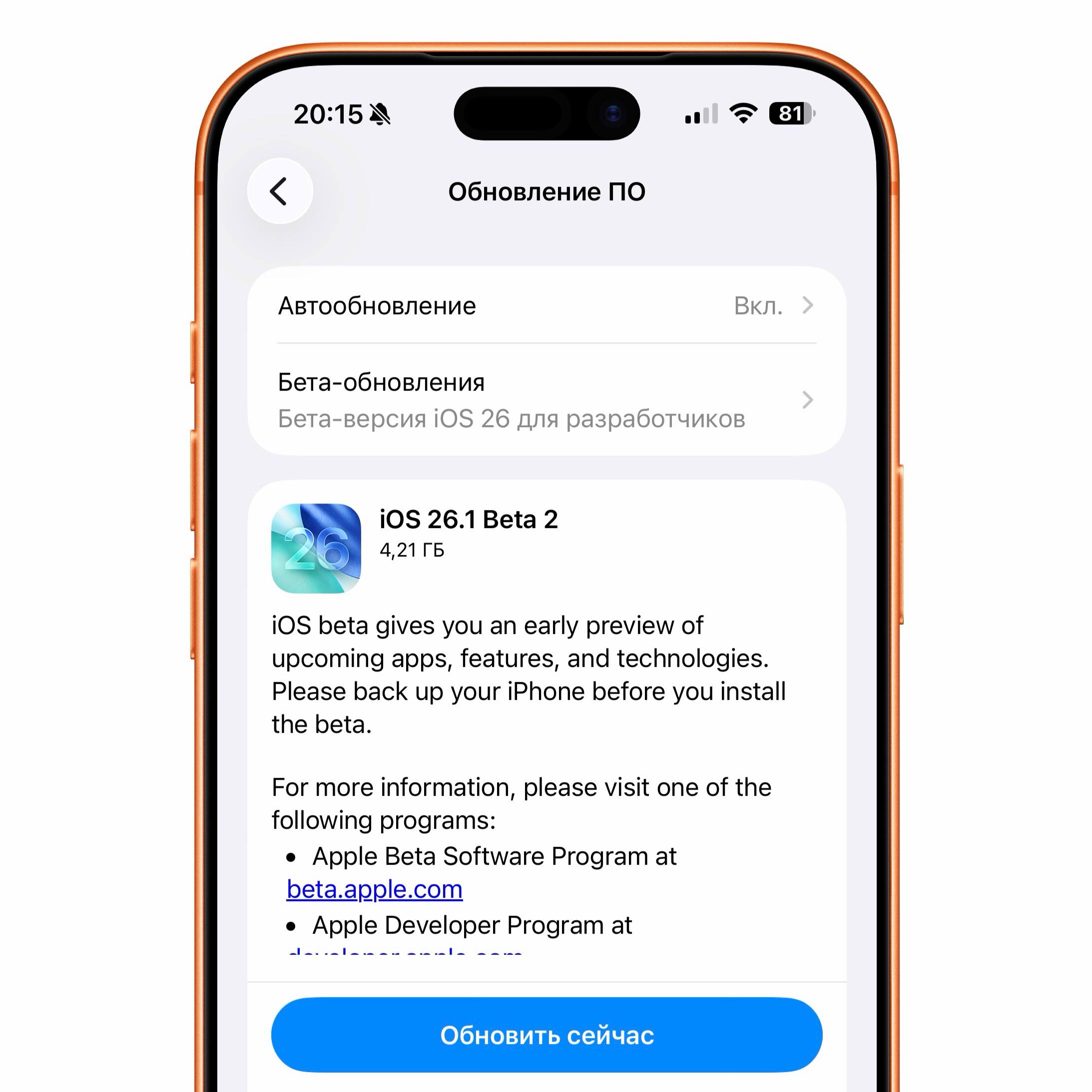 Стала доступна iOS 26 1 Beta 2 Вероятно крупных обновлений нет Apple скорее закроет уязвимости Ранее в Beta 26 1 мы видели эффект Liquid Glass который добрался до Телефона появилось несколько жестов в Музыке