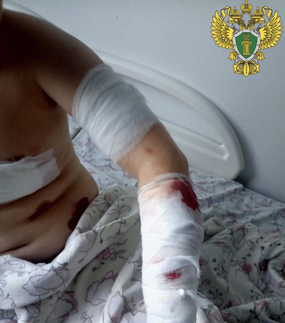 Приморской межрайонной прокуратурой приняты меры по судебной защите прав несовершеннолетнего подвергшегося нападению собаки Приморская межрайонная прокуратура провела проверка по факту нападения собаки на несовершеннолетнего ребенка Установлено что в июне 2025 года в деревне Перхачево Приморского муниципального округа оставленная без должного присмотра собака породы лайка напала на 11 летнего мальчика причинив ему укушенные раны кисти предплечья и грудной клетки В целях защиты прав ребенка Приморский межрайонный прокурор обратился в суд о взыскании с владельца животного компенсации морального вреда причиненного малолетнему  Решением суда исковые требования прокурора удовлетворены в пользу пострадавшего взыскана компенсация в размере 55 тысяч рублей