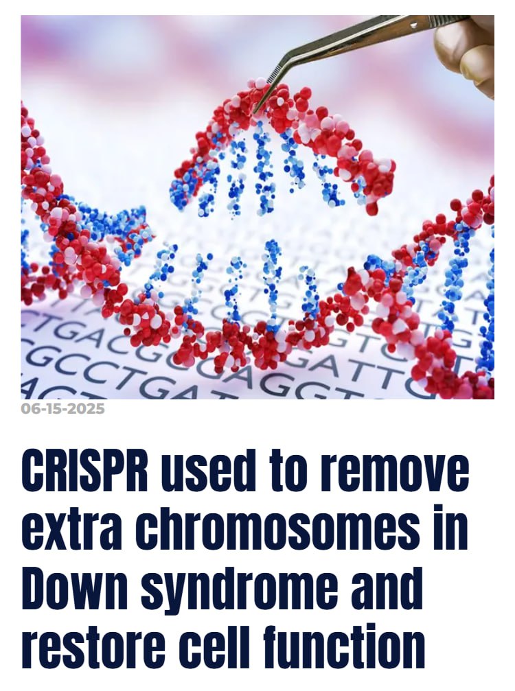 Учёные совершили прорыв: с помощью технологии CRISPR они удалили лишнюю 21-ю хромосому из клеток людей с синдромом Дауна. После вмешательства клетки начали вести себя как обычные — без признаков аномалии. Но есть важные оговорки: – Это удалось только в лабораторных условиях, в пробирке. До клинического применения — долгий путь. – CRISPR — мощный, но рискованный инструмент: вместе с «лишним» может затронуть и нужные участки ДНК, что чревато раковыми мутациями. – Речь не о полном «лечении», а о доказательстве, что редактирование хромосом в принципе возможно. Если технология будет доработана, это может стать основой терапии для других тяжёлых генетических нарушений — например, синдромов Патау и Эдвардса. Редактирование человека — уже не фантастика, а начало новой реальности.