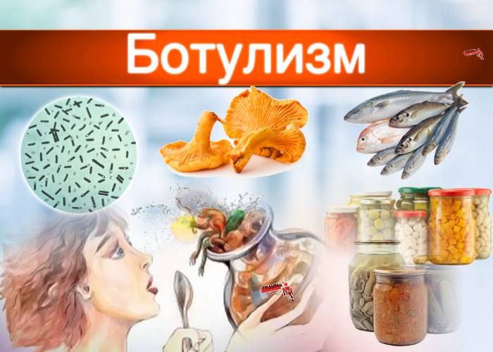 Врачи Республиканского центра инфекционных болезней в Дагестане борются за жизни членов двух семей госпитализированных с тяжелой формой ботулизма сообщает пресс служба медучреждения Причиной отравления стало употребление домашних консервированных продуктов Как рассказала заведующая взрослым кишечным отделением центра Джамиля Амирова с наступлением поздней осени риск подобных отравлений традиционно возрастает Ботулизм остается одной из наиболее опасных угроз возникающих при употреблении консервированных продуктов Это серьезное отравление которое поражает нервную систему и может привести к тяжелым последствиям Иногда достаточно мельчайшей частицы почвы оставшейся на овощах после мытья чтобы в банку с соленьями попали клостридии ботулизма В безвоздушной среде они начинают производить ботулотоксин Это сильнейший смертельный яд Даже малое его количество приводит к параличам Без экстренного лечения ботулизм часто приводит к смерти отметила она Распознать зараженный продукт невозможно внешний вид и вкус не меняется крышка банки не вздувается